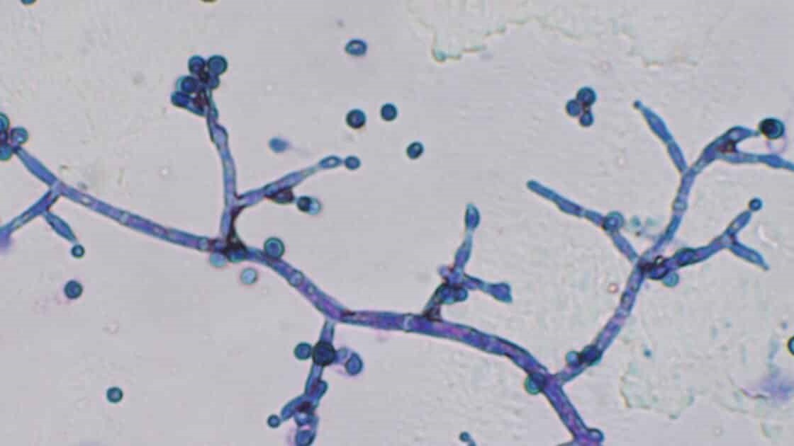 Bea Trichoderma